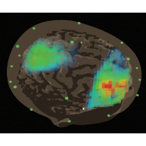 BrainAvatar Analysis